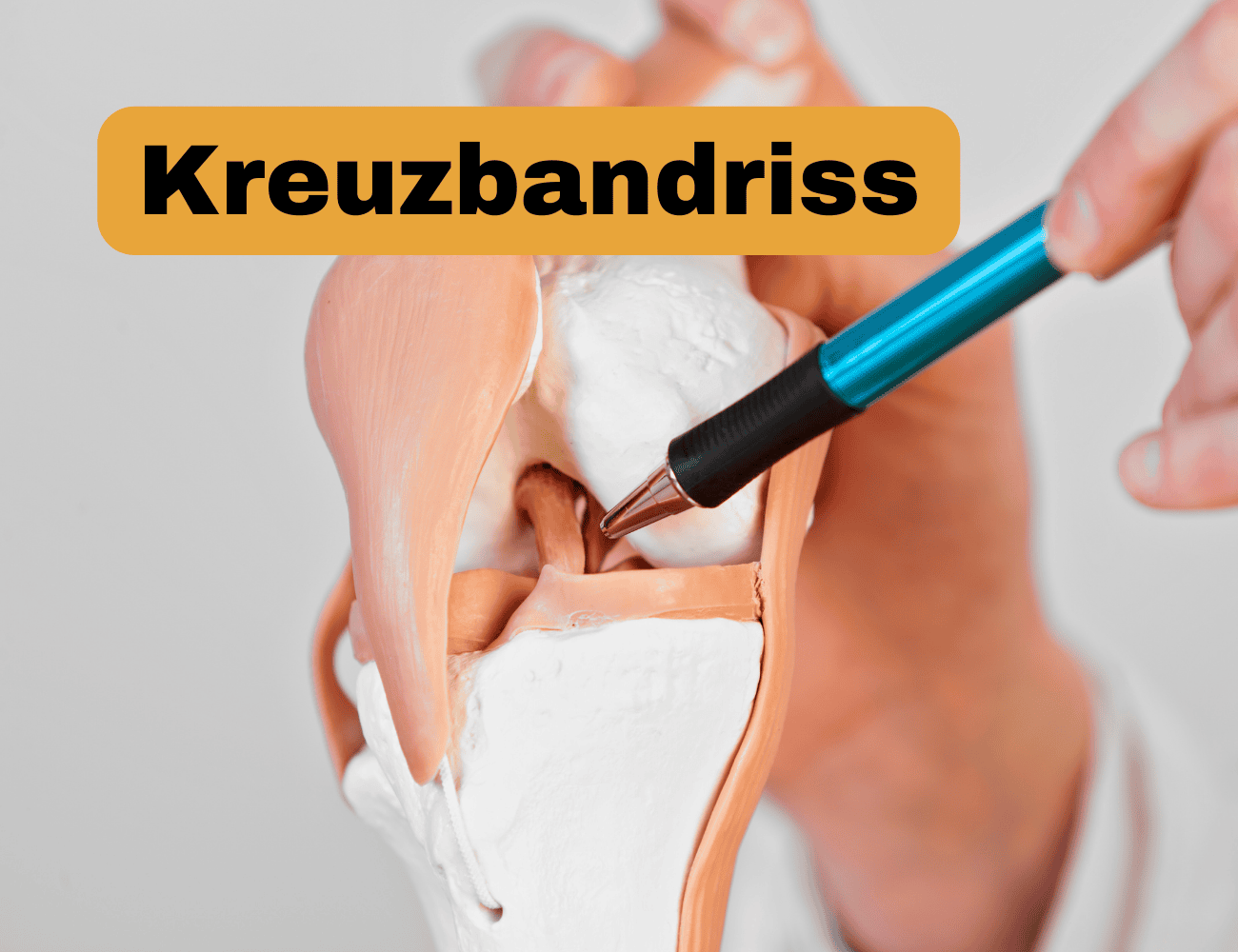 Häufigste Gründe für Knieschmerzen und deren Prävention