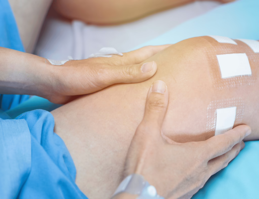 Die ersten Tage nach Kreuzbandriss Operation 10 hilfreiche Tipps