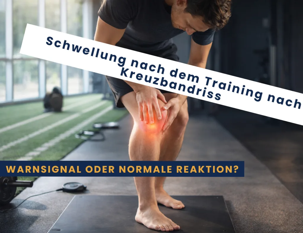 Schwellung nach dem Training bei Kreuzbandriss - Warnsignal oder normale Reaktion?